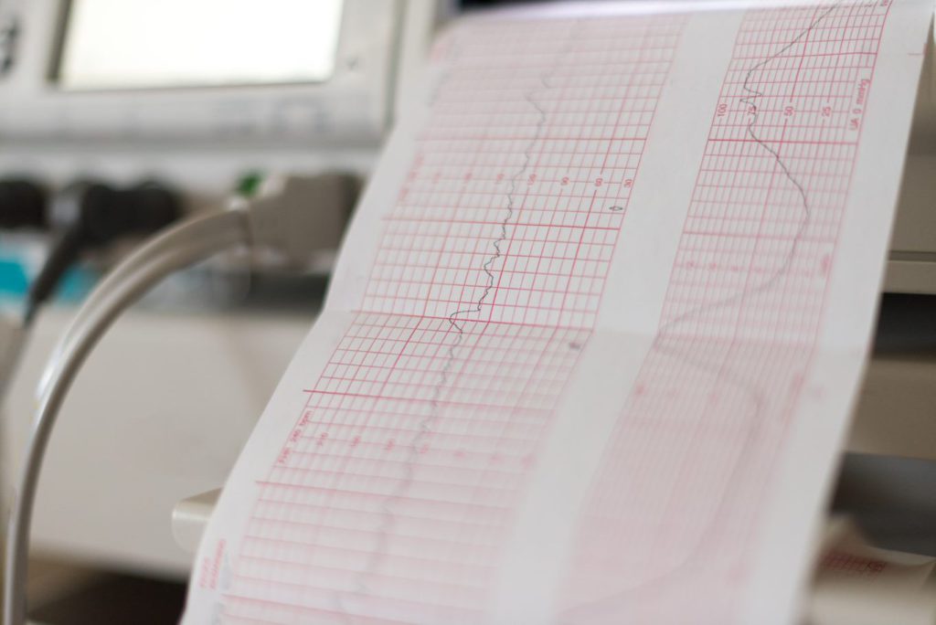 AWHONN Intermediate Fetal Heart Monitoring Northern Arizona Healthcare